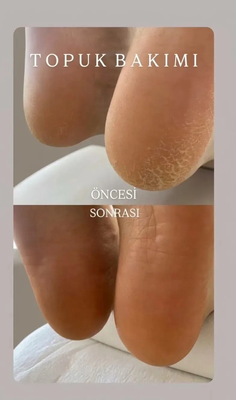 Therapy Gölbaşı Nail Art fotoğraf 4